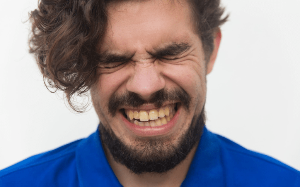 How to Fix Yellow Teeth Fast Before an Event: Quick Whitening Tips That Actually Work